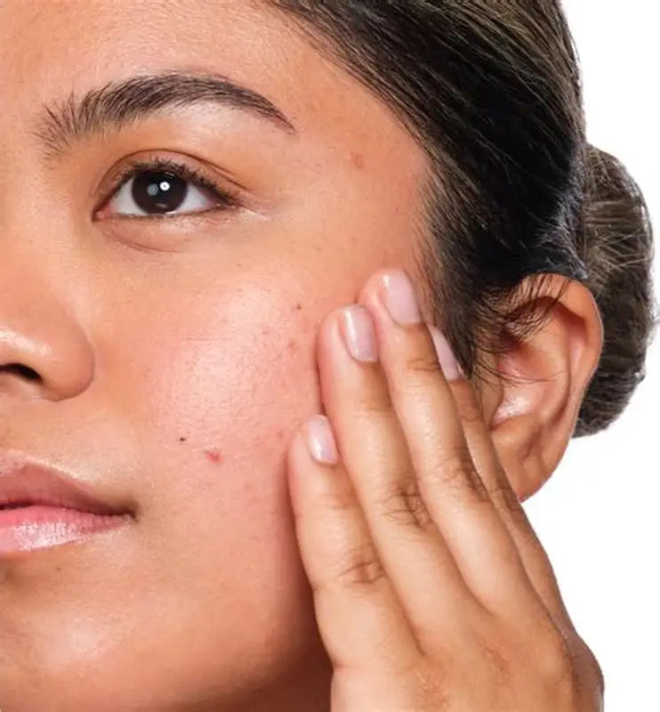 Solución de Ácido Salicílico 2% | The Ordinary